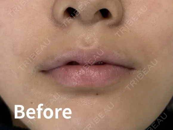 リップアートメイク before画像 メイン用