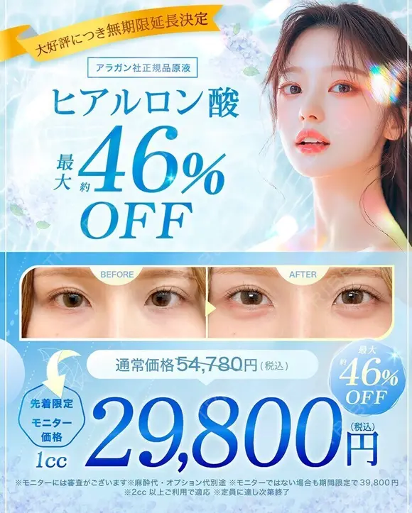 顎　ヒアルロン酸 after画像 メイン用