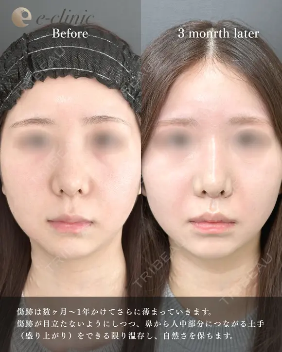 人中短縮 before画像 メイン用