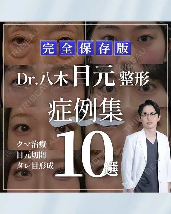 目元の症例集（クマ治療・目元拡大術） after画像 メイン用