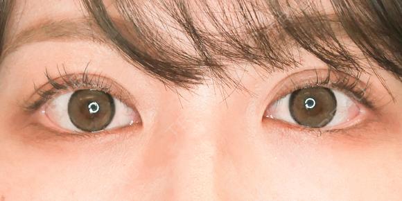 埋没法プレミアム after画像 メイン用