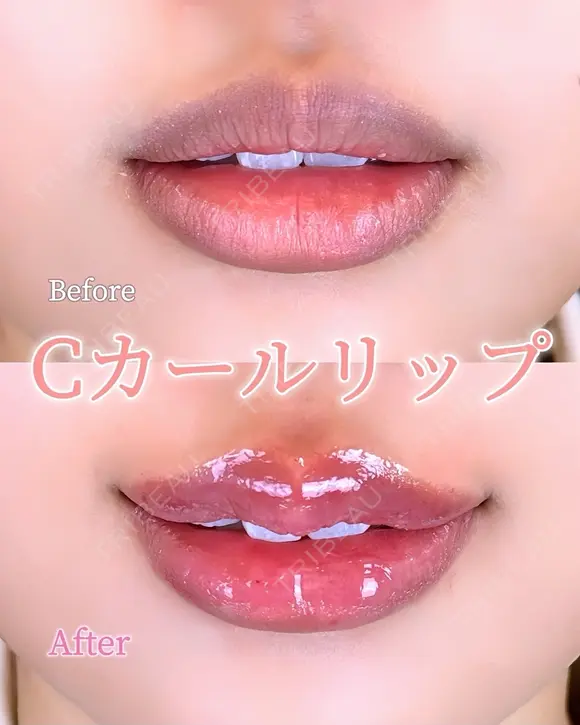 Cカールリップ before画像 メイン用