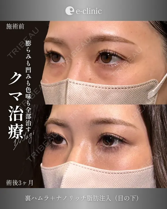 裏ハムラ after画像 メイン用