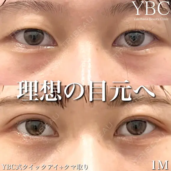 【💌YBC式クイックアイ💌】 after画像 メイン用