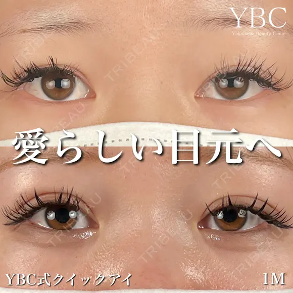 【🍍YBC式クイックアイ🍍】 before画像 メイン用