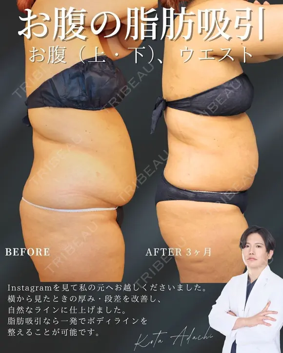 ウエスト－10㎝✨ before画像 メイン用