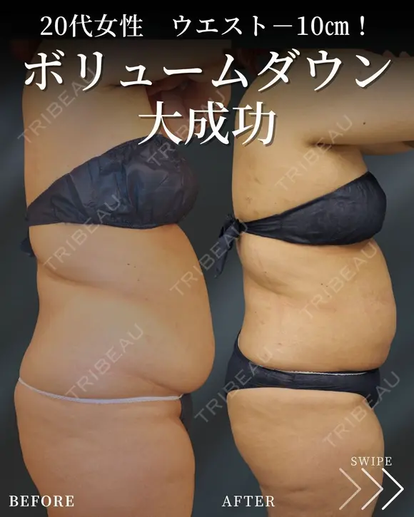 ウエスト－10㎝✨ after画像 メイン用