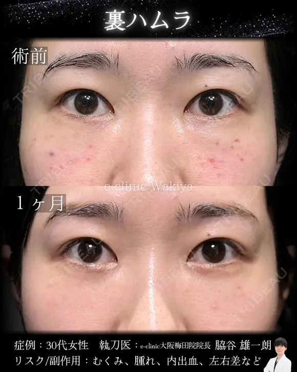 裏ハムラ before画像 メイン用