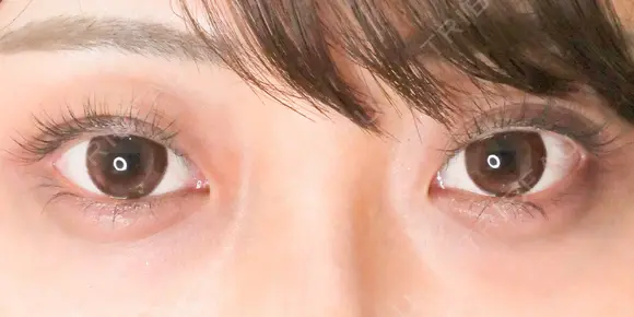 埋没法プレミアム before画像 メイン用