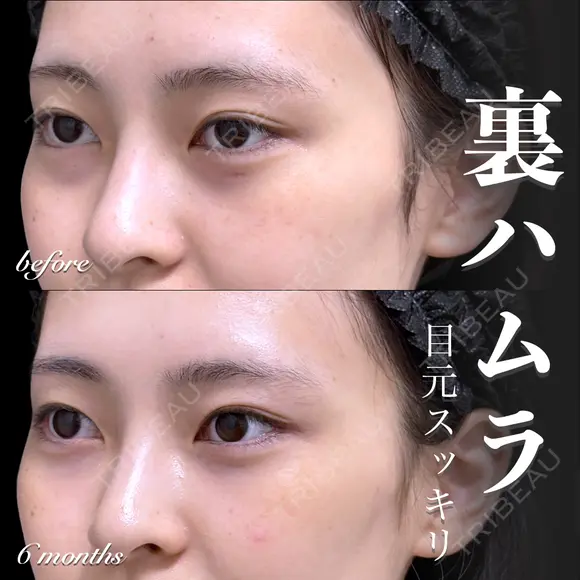 裏ハムラ before画像 メイン用