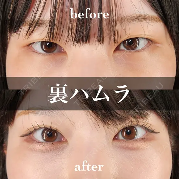 裏ハムラ 30日後 メイン用