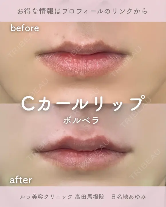 Cカールリップ after画像 メイン用