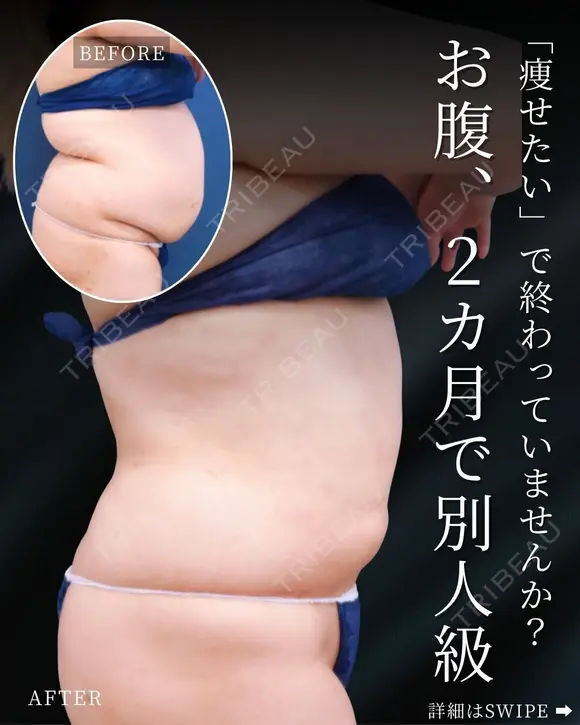 2ヵ月で別人級👀❣ after画像 メイン用