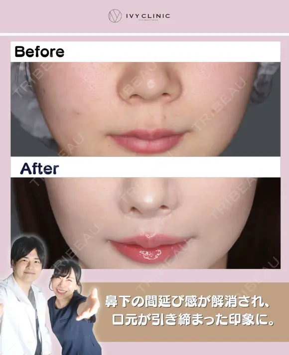 人中短縮 after画像 メイン用