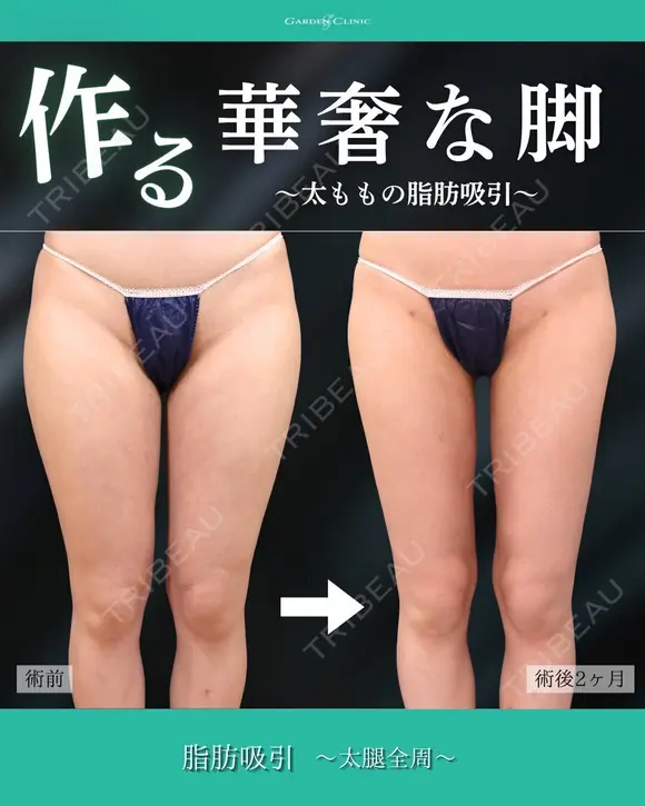 華奢な脚に👠✨ after画像 メイン用
