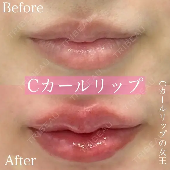 Cカールリップ before画像 メイン用