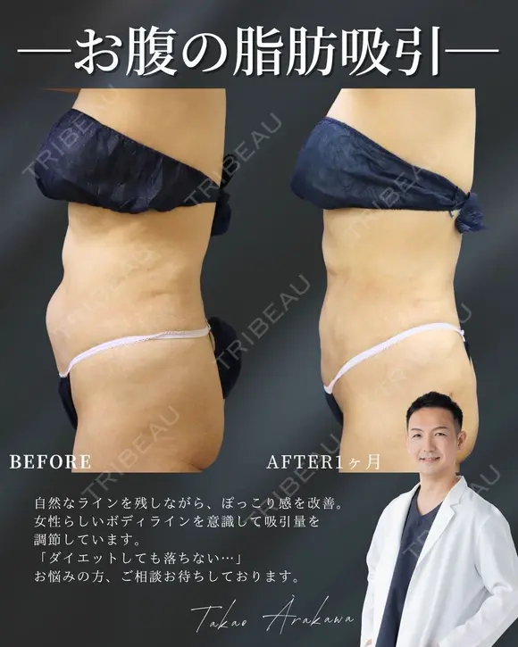 確実に体型チェンジ‼✨ before画像 メイン用