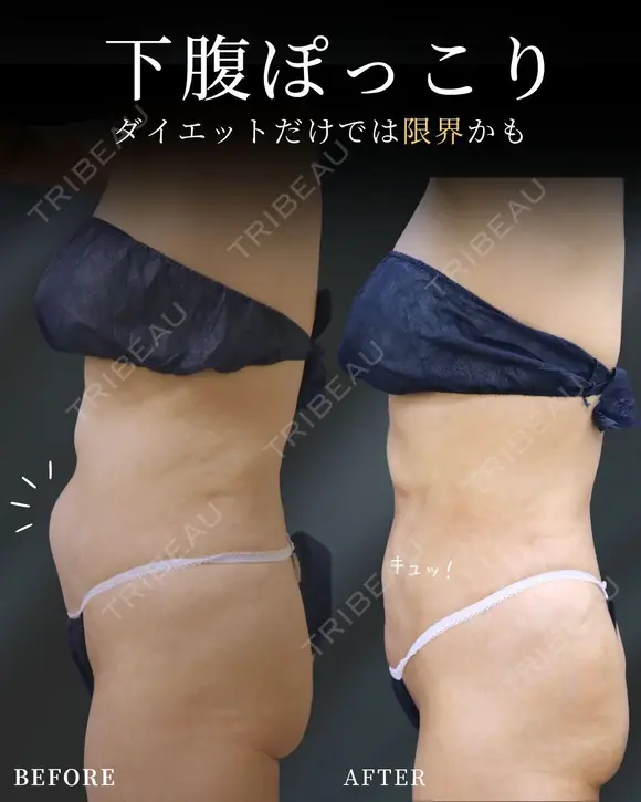 確実に体型チェンジ‼✨ after画像 メイン用