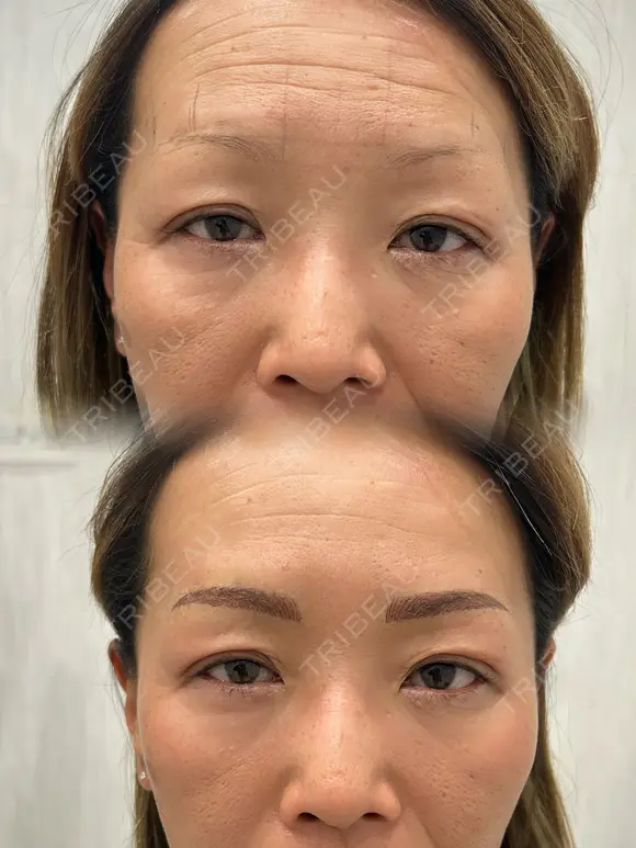 アートメイクで激変✨ after画像 メイン用