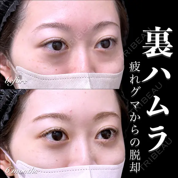 裏ハムラ before画像 メイン用