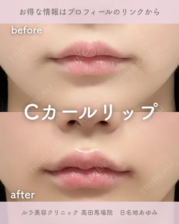 Cカールリップ before画像 メイン用