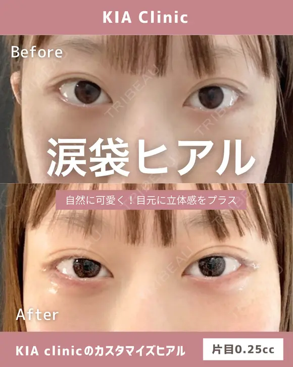 自然に可愛いく！目元に立体感をプラス！！ after画像 メイン用