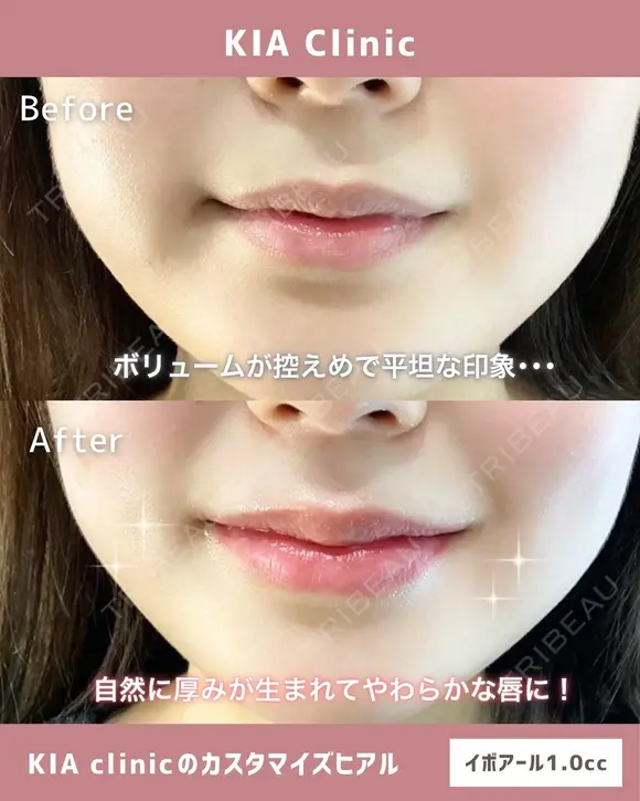 自然に叶う！理想のうるつやリップ！ before画像 メイン用