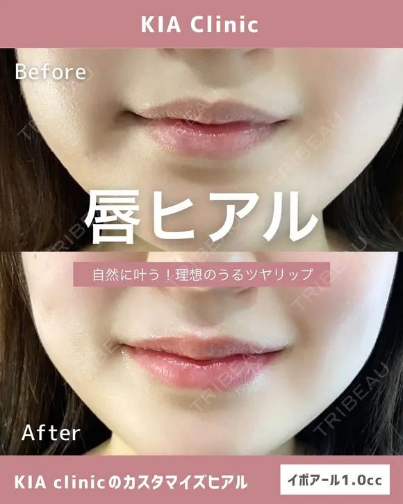 自然に叶う！理想のうるつやリップ！ after画像 メイン用