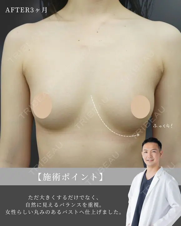 理想のバスト作れます!!🩷 before画像 メイン用