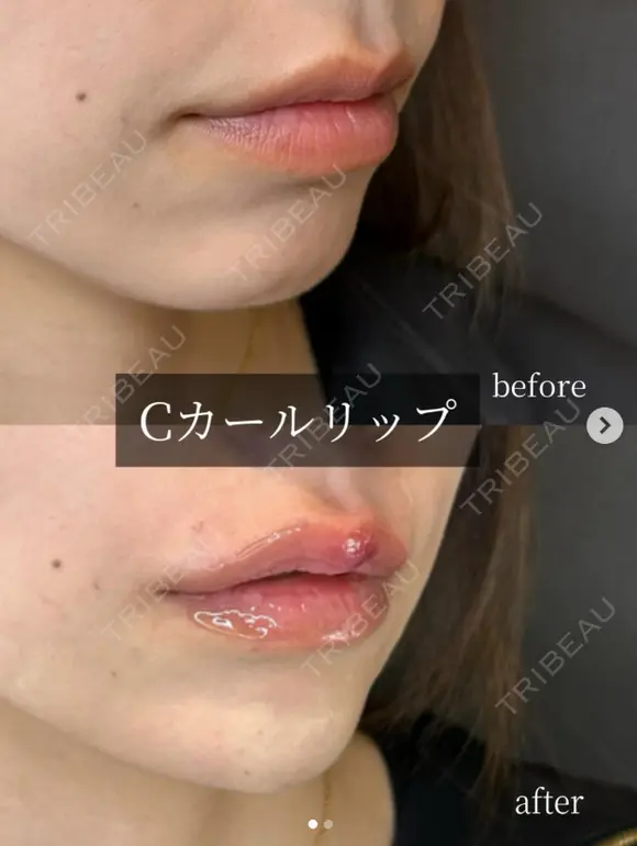 Cカールリップ after画像 メイン用