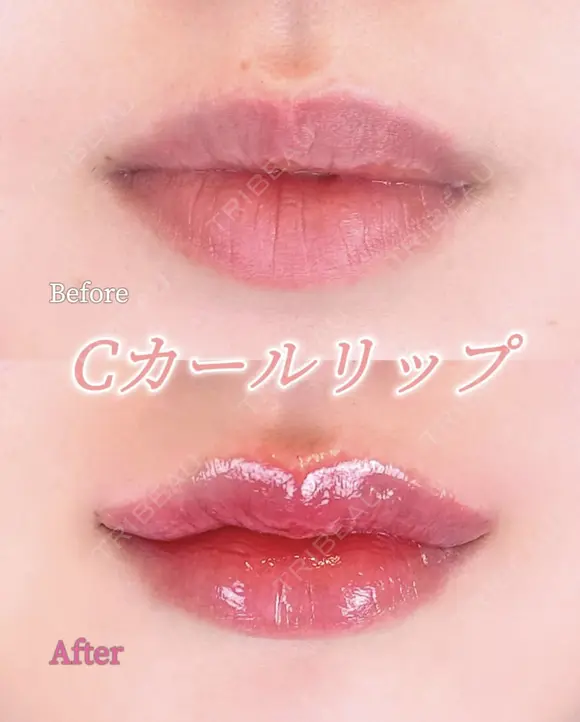 Cカールリップ 0日後 メイン用