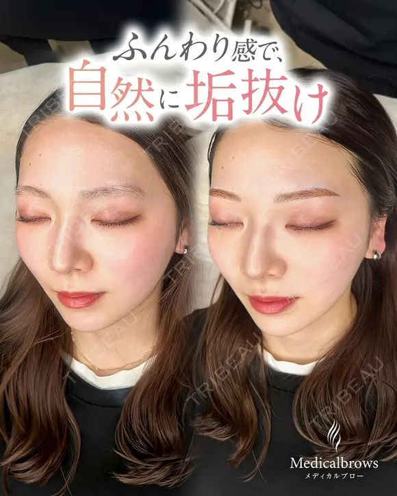 ふんわり眉で自然に垢抜け before画像 メイン用