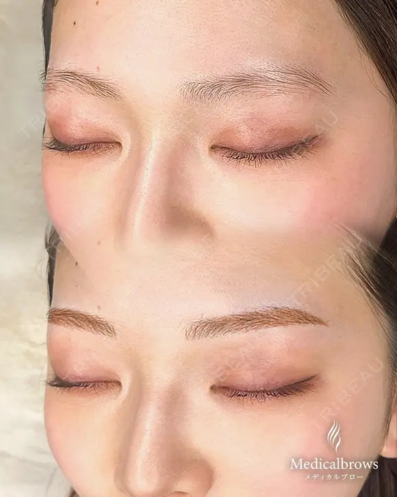 ふんわり眉で自然に垢抜け 0日後 メイン用