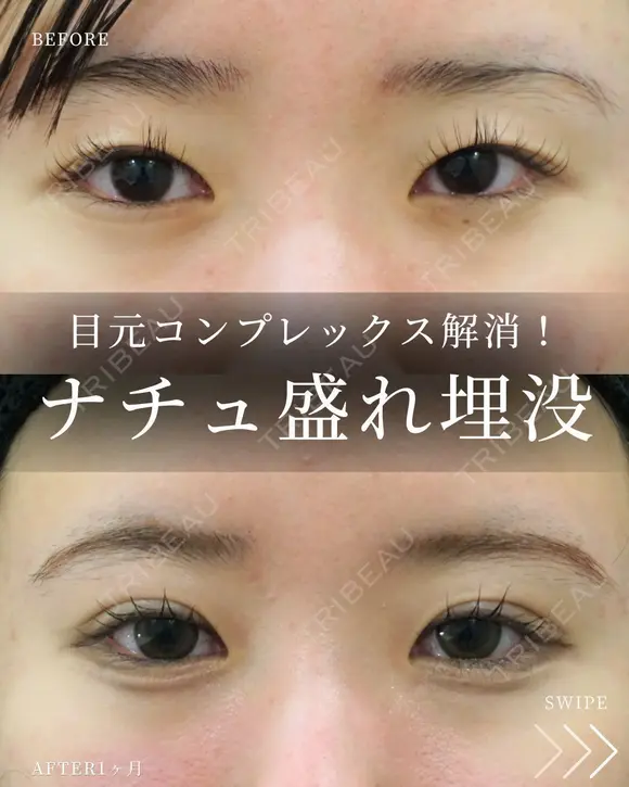 目元コンプレックス解消👀💖 after画像 メイン用
