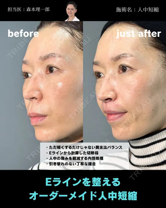 人中短縮 before画像 メイン用