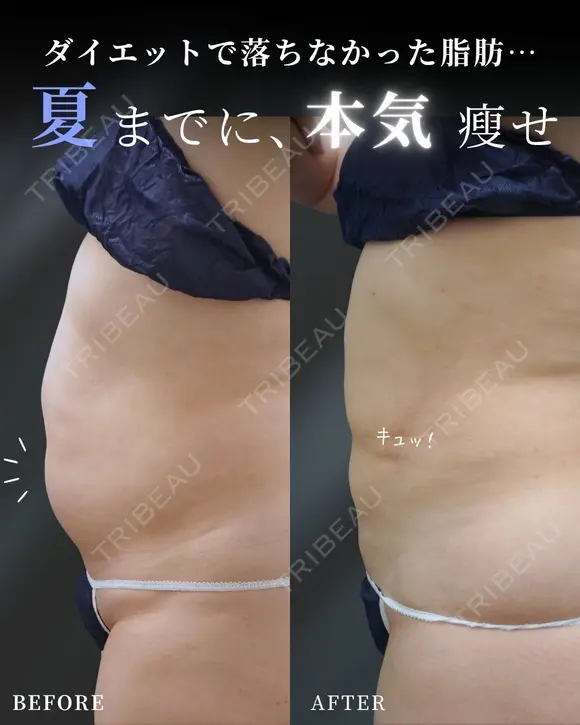 夏までに本気瘦せ！🌻 after画像 メイン用