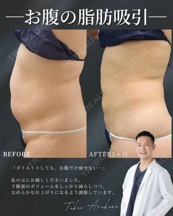 夏までに本気瘦せ！🌻 before画像 メイン用