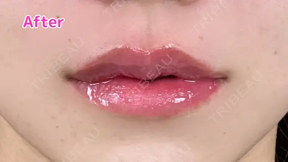 Cカールリップ　ボルベラ after画像 メイン用