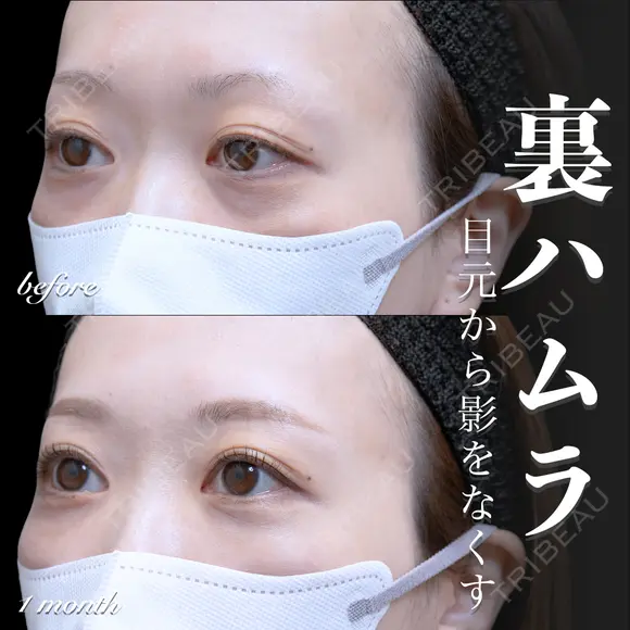 裏ハムラ before画像 メイン用