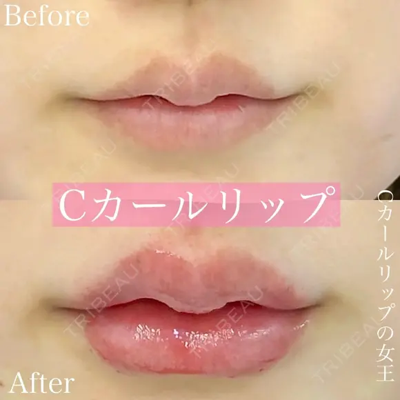 Cカールリップ after画像 メイン用