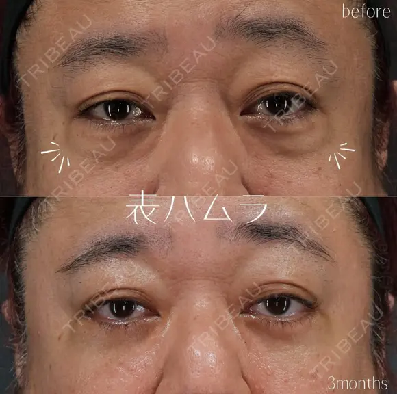 表ハムラ after画像 メイン用
