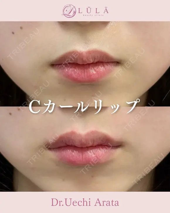 Cカールリップ after画像 メイン用