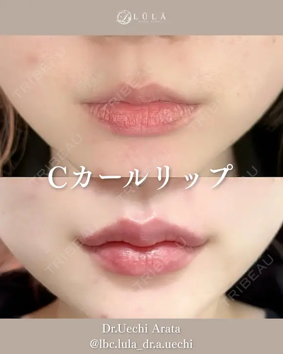 Cカールリップ before画像 メイン用