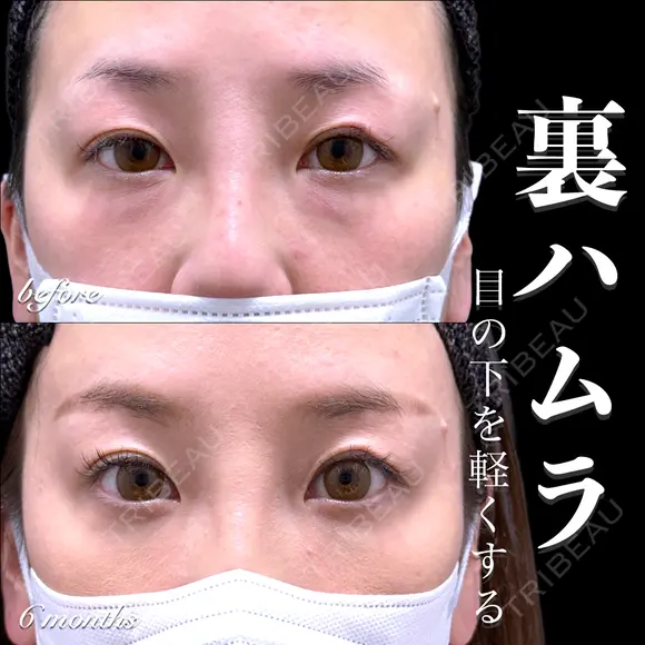 裏ハムラ before画像 メイン用