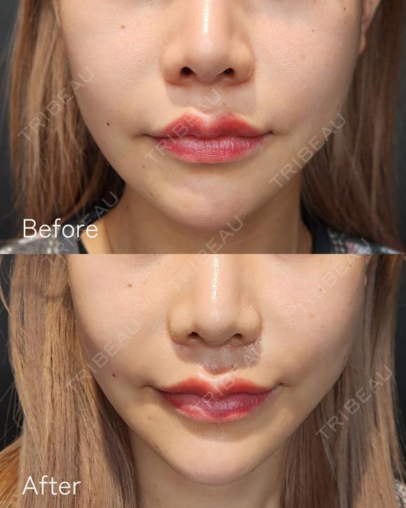 オリジオ💎300shot after画像 メイン用