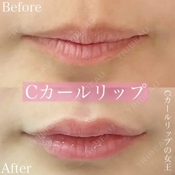 Cカールリップ before画像 メイン用