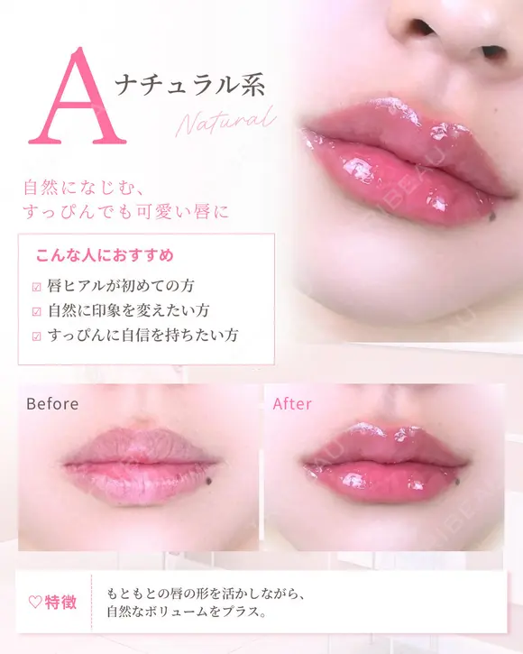 Cカールリップ　ボルベラ before画像 メイン用