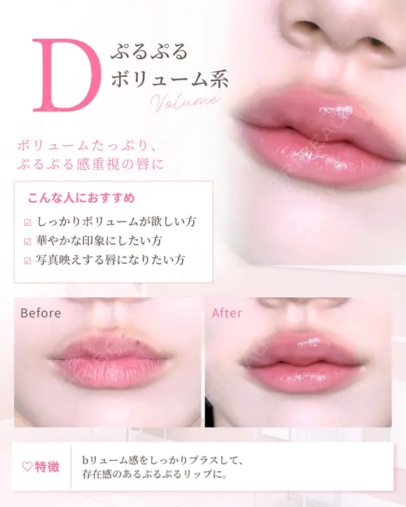 Cカールリップ　ボルベラ after画像 メイン用