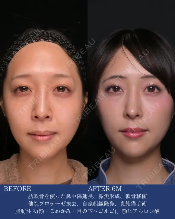 自然な垢抜けで可愛さアップデート before画像 メイン用