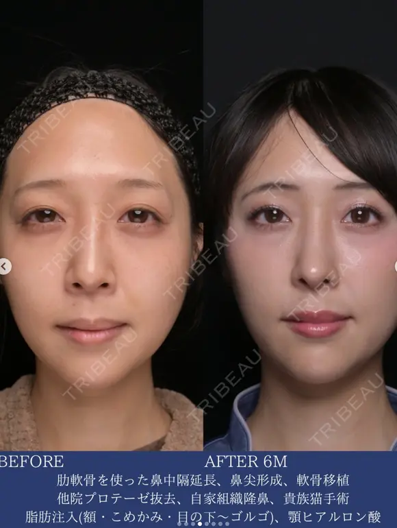 自然な垢抜けで可愛さアップデート 180日後 メイン用